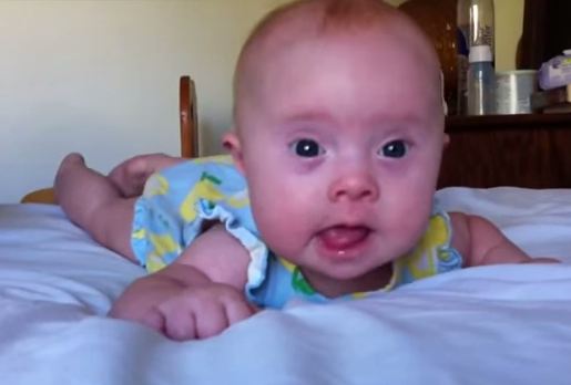 Adoptaron a una beba con Síndrome de Down y su felicidad creció infinitamente día a día. Conoce a Suny en este video!