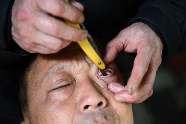 China: El limpiador de ojos
